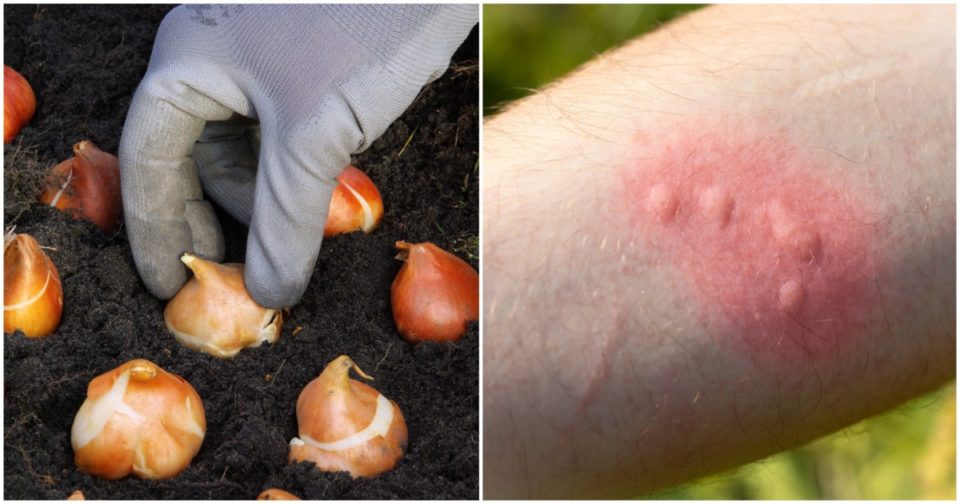 8-surprising-plants-that-can-seriously-irritate-your-skin